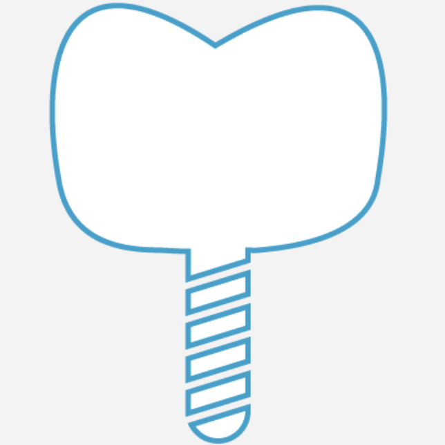 インプラント治療計画ソフト 3Dシミュレーション